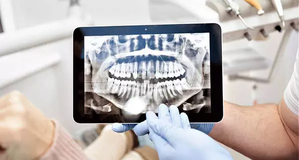 Dijital Tomografinin Avantajları